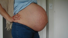Болит живот на 35 неделе беременности