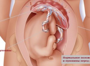 Болит живот как при месячных на 40 неделе беременности