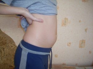 На 9 неделе беременности тянет живот