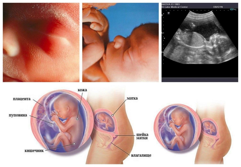Как выглядит ребенок в 19 недель беременности
