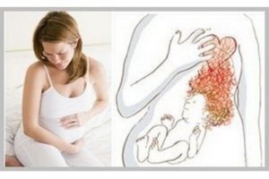 Изжога на 13 неделе беременности
