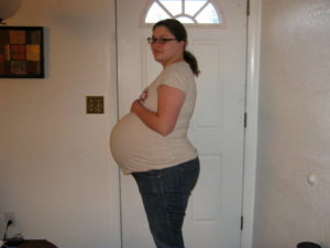 35 неделя беременности двойня