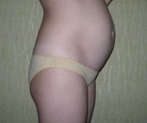 Тянет живот на 15 неделе беременности нормально ли это