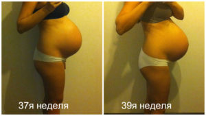 Живот маленький на 37 неделе беременности