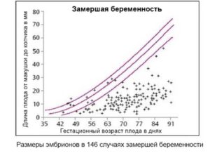 Процент замерших беременностей в первом триместре