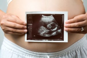 Как делают первое узи при беременности в 12 недель