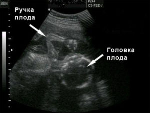 Питание на 19 неделе беременности