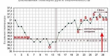 Температура на 28 неделе беременности