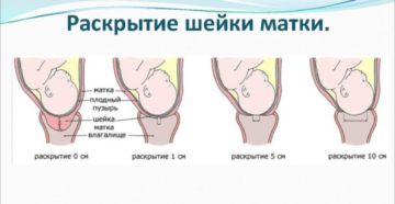 39 неделя беременности как ускорить раскрытие шейки матки