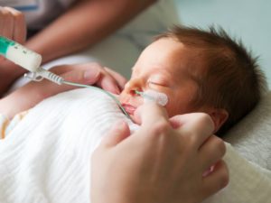 Кормление недоношенного ребенка через зонд