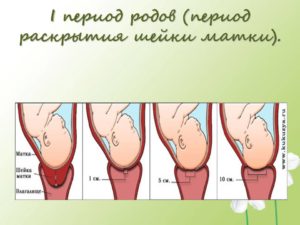 40 неделя беременности раскрытие 2 пальца когда роды