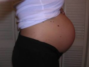 Маловодие при беременности 39 недель