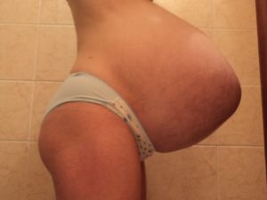 Каменеет живот на 33 неделе беременности