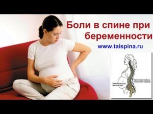 30 неделя беременности болит поясница