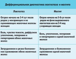 Что делать при мастите у кормящих мам