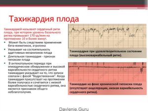 Тахикардия у плода на 36 неделе беременности