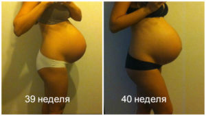 40 недель беременности живот каменеет