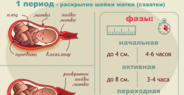 Частые тренировочные схватки на 37 неделе беременности