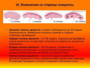 Структурные изменения плаценты при беременности 32 недели