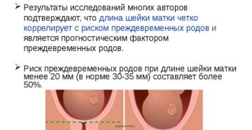 Шейка матки короткая при беременности 24 недели