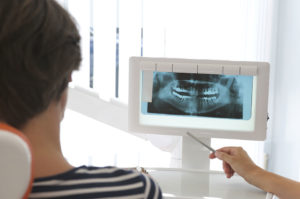 Рентген зуба при беременности 2 триместр