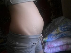 Живот при беременности на 9 неделе очень вырос