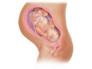 Плацента на 38 неделе беременности