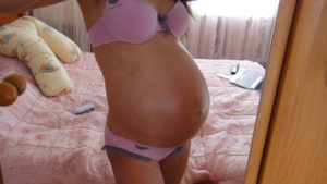 Тянет поясницу и низ живота 33 недели беременности