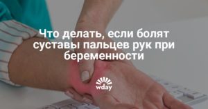 Болят суставы пальцев рук при беременности 38 недель