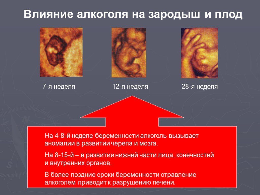 Алкоголь на 3 неделе беременности