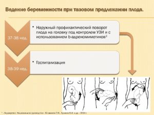 На 31 неделе беременности тазовое предлежание