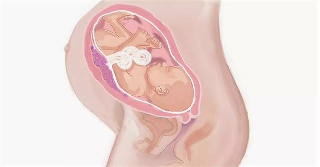 28 неделя беременности тянет. 34 Неделя беременности акушерские недели. Плод ребенка в 34 недели беременности. Расположение плода на 34 неделе беременности. Матка в 32 недели беременности.